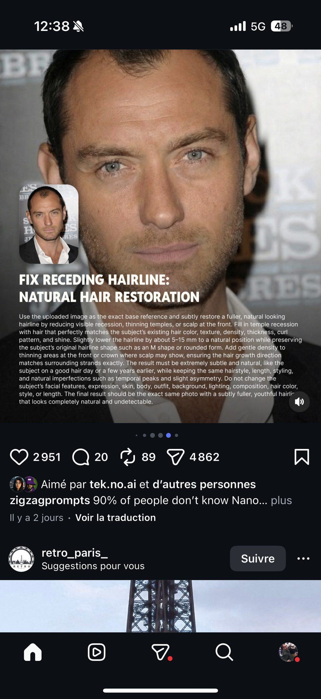 Prompt IA "Fix Receding Hairline" — retouche capillaire réaliste