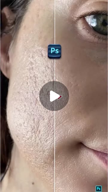 Retouche de peau sous Photosho